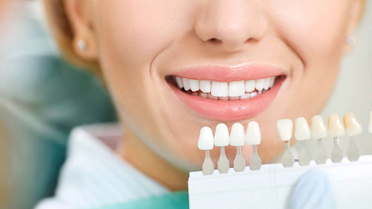 How to Whiten Your Teeth with Whitening Gel